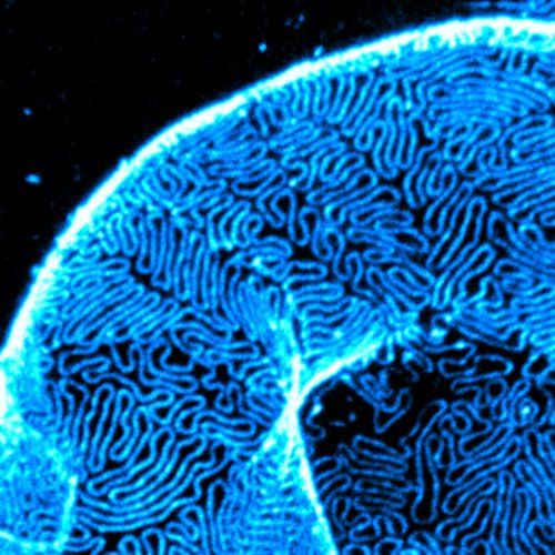 STED super-resolution detail of a glomerulus, showing the slit-diaphragm structure. Magnephy in-house imaging.
