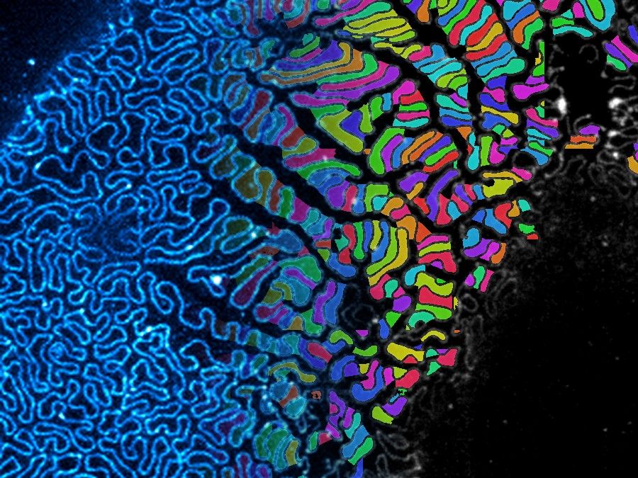 Raw super-resolution micrograph of kidney foot processes fading into its AI segmentation, each structure individually colour-labelled. Magnephy in-house.
