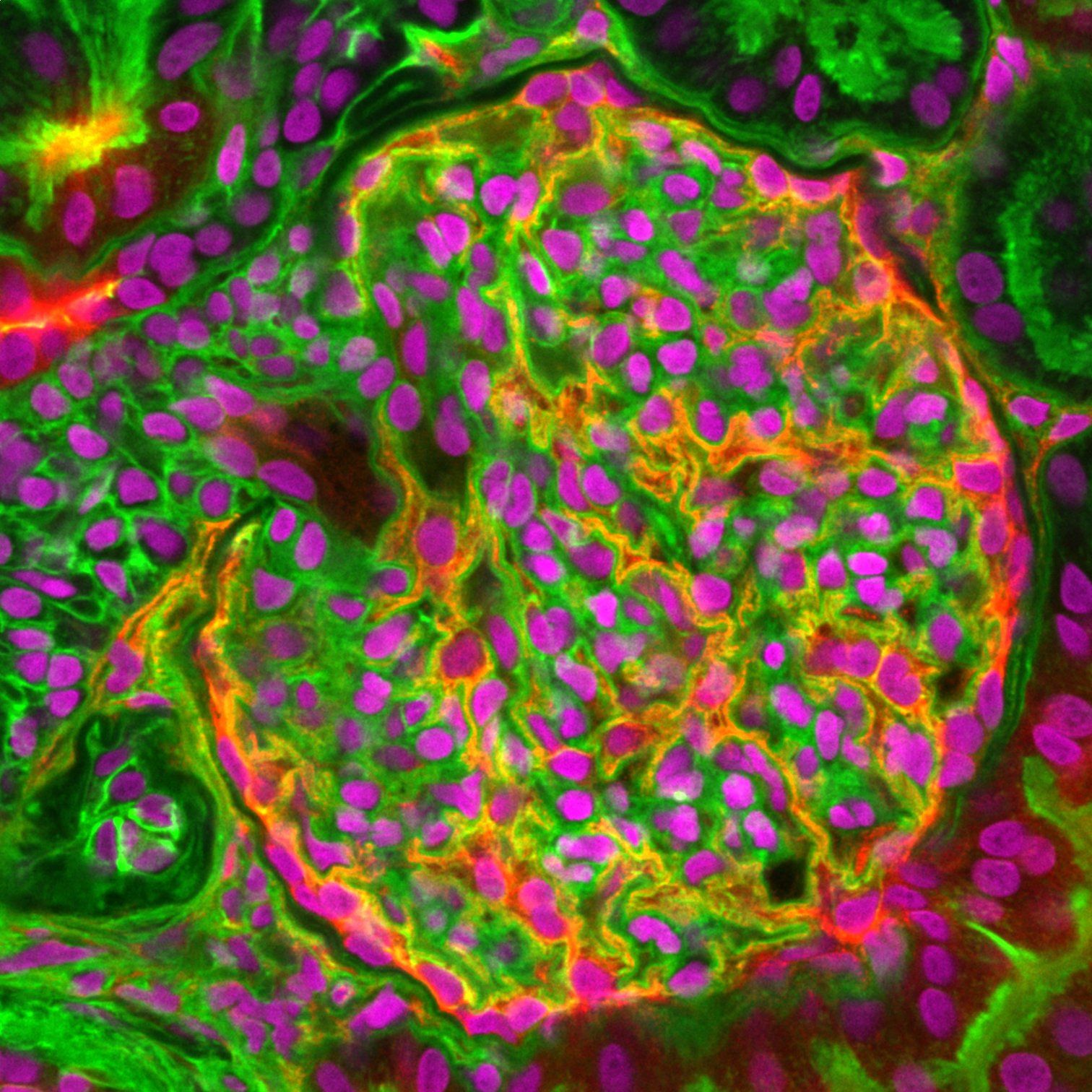 Multiplex view of a glomerulus with multi-channel markers. Magnephy in-house imaging.
