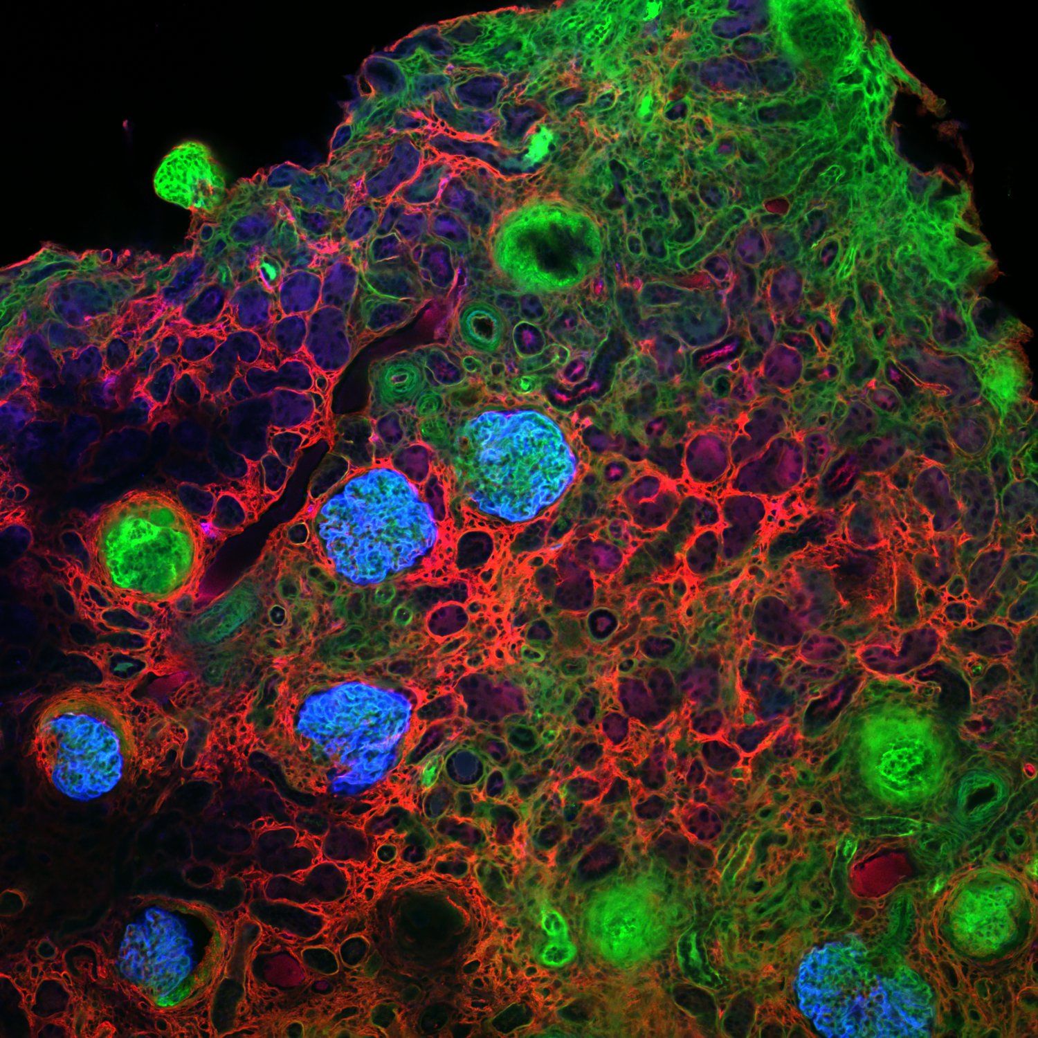 Multi-colour overview of a kidney biopsy section, showing tissue context for drug-target localisation. Magnephy in-house imaging.
