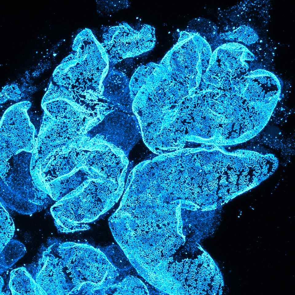 Multi-glomerulus view by STED super-resolution microscopy, showing the slit-diaphragm network in cleared kidney tissue. Magnephy in-house imaging.
